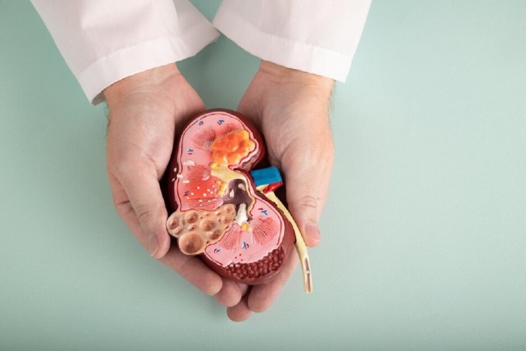 Stage 3 Chronic Kidney Disease: Symptoms and Homeopathic Treatment